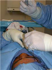 Plastic Surgery Frank Stile